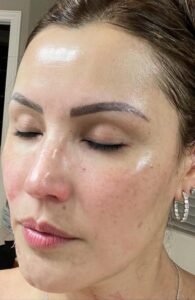 FACIAL 03