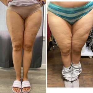 Weight Loss (S)