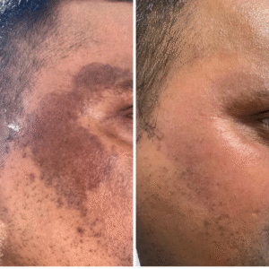 IPL – Single Session